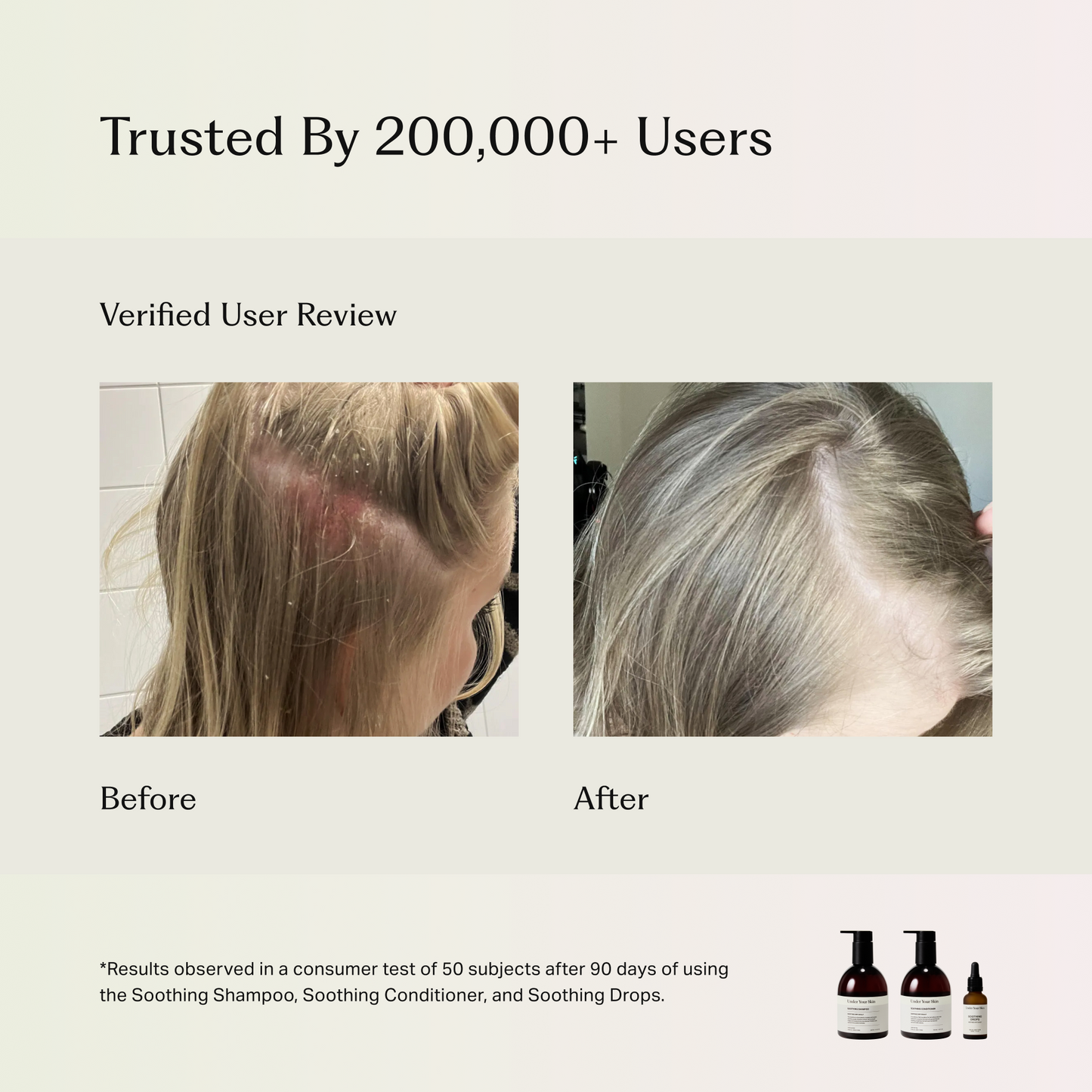 Soothing Scalp Treatment Drops