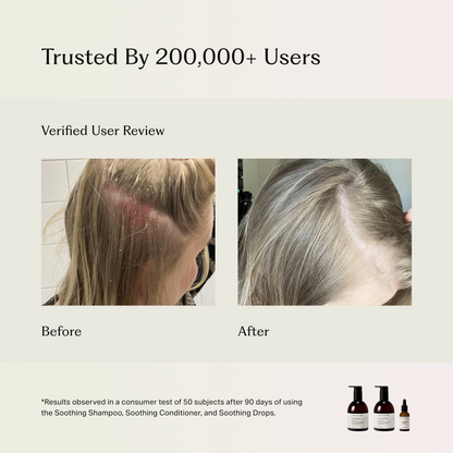 Soothing Scalp Treatment Drops