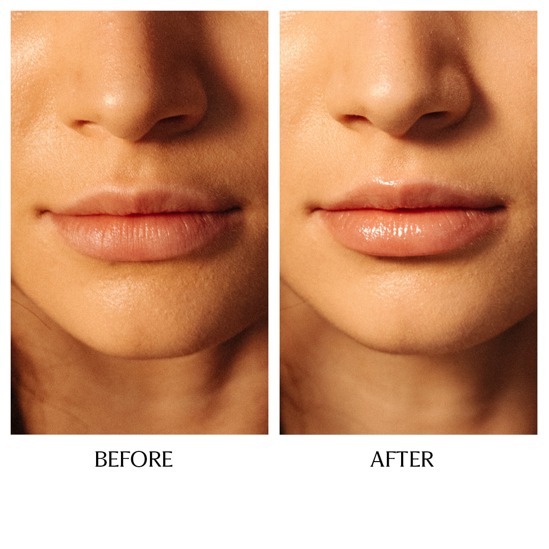 Barrier Boost Lip Balm