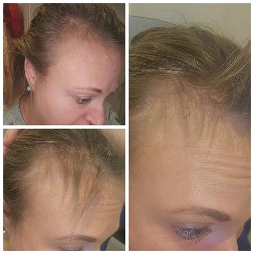 Kundbild före och efter användning av Hair Growth.