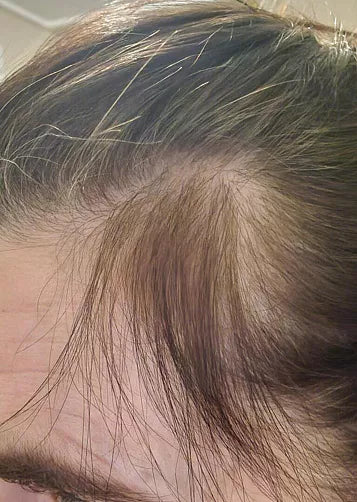 Kundbild före och efter användning av Hair Growth.