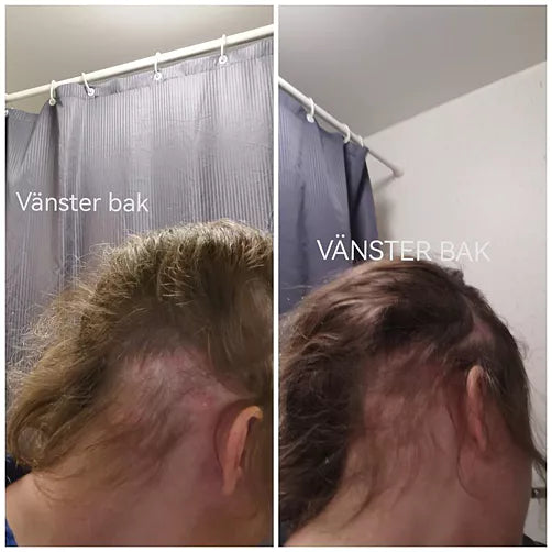Kundbild före och efter användning av Hair Growth.
